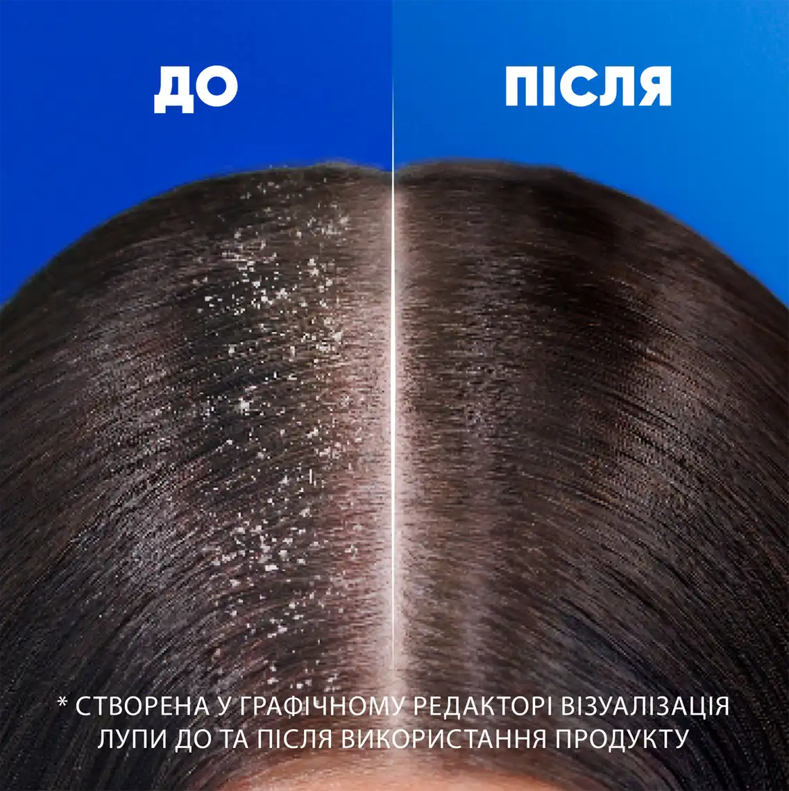 Фото 6 - Шампунь Head & Shoulders Глибоке зволоження проти лупи 400 мл